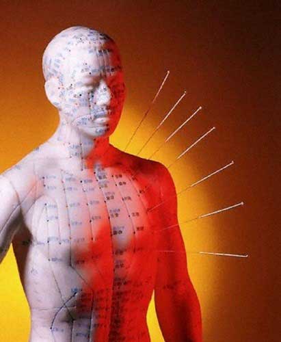 What can Acupuncture help with? | 101 Osteopathic Centre | GTA Healer